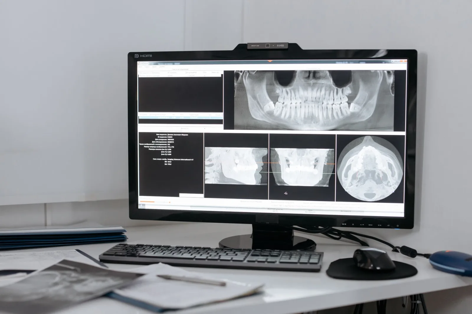 A panoramic X-ray and CBCT slices on a clinic monitor — the imaging that shows what is actually going on