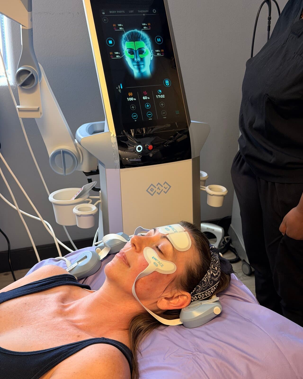 Real EMFACE® patient — our operatory