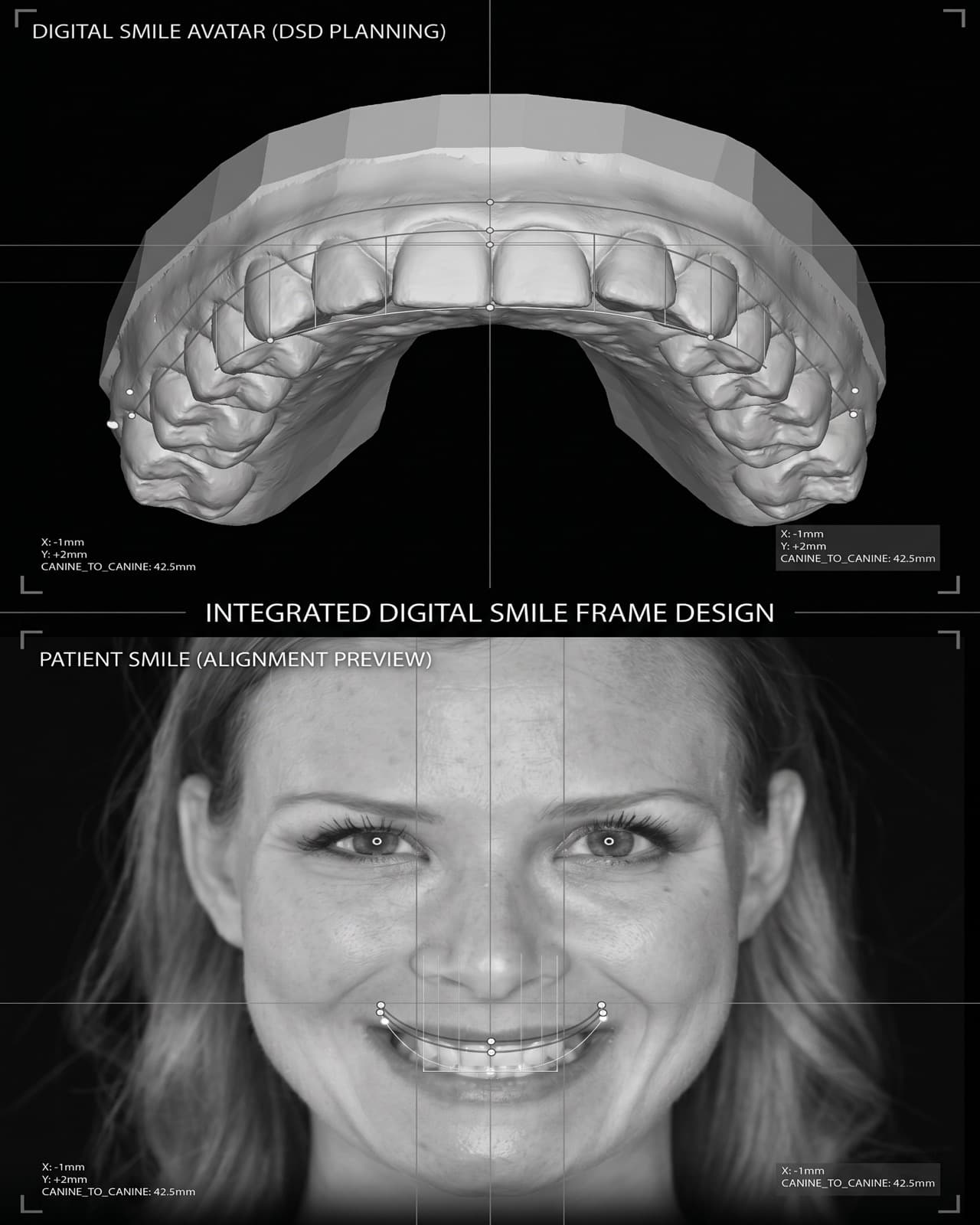 DSD facial photo + design overlay