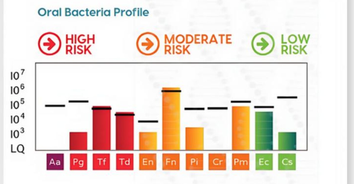 An oral bacteria profile chart: eleven bacteria shown as bars, grouped into high, moderate and low risk. Aa, Pg, Tf and Td are the high-risk group.