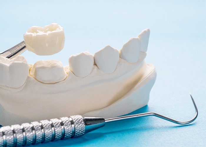 dental crown