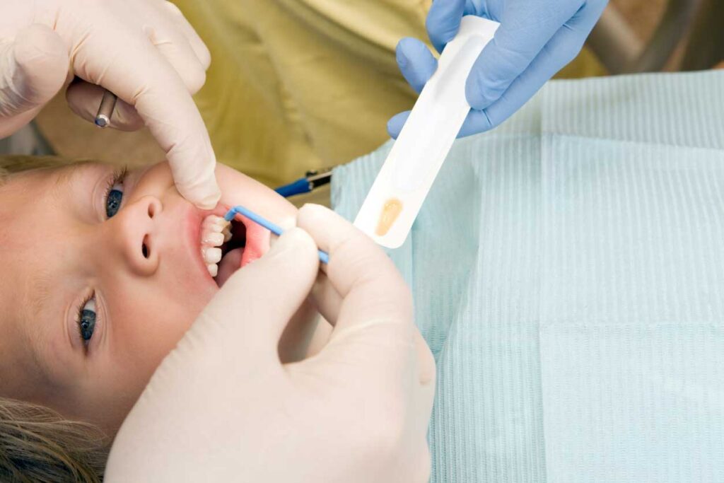 kid on dental chair during fluoride treatment